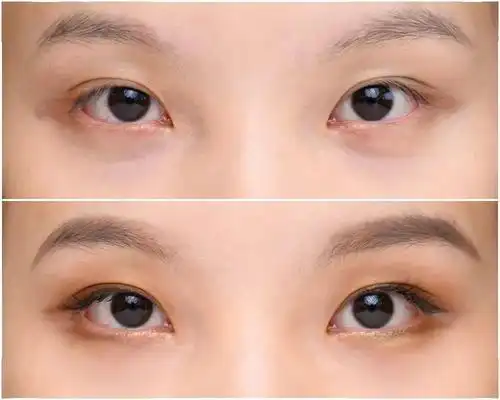 张雨绮为啥越看越可爱,这一点真的很重要_眼睛