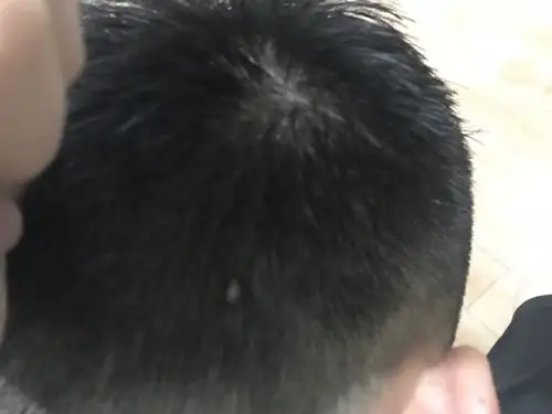 脑袋后面有一个小疙瘩,不知道是什么