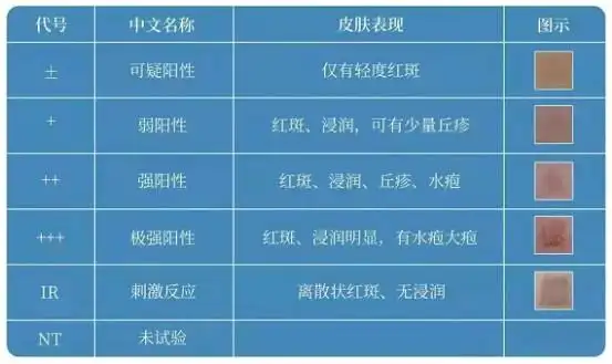 斑贴试验皮肤科开展过敏原检测