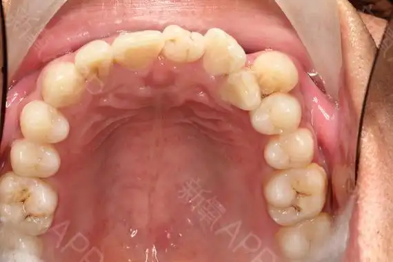 口腔内部高清晰图片