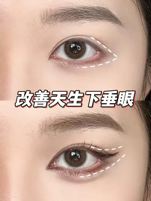 徒手调整眼型三步改善天生下垂耷拉眼