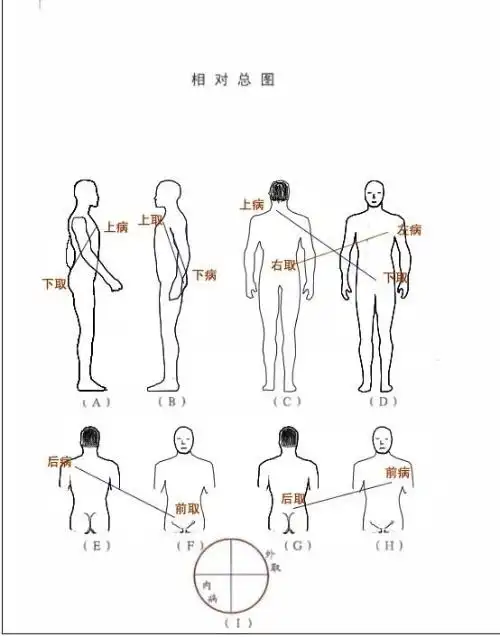 相对:   相对疗法是本疗法的主要内容之一,很多同道都知道这是内经所