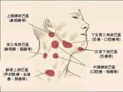 颈部淋巴脖子淋巴脸下淋巴结在哪里脸部淋巴结_999穴位网