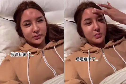 脑门凹陷一块太吓人脑门有一块凹陷