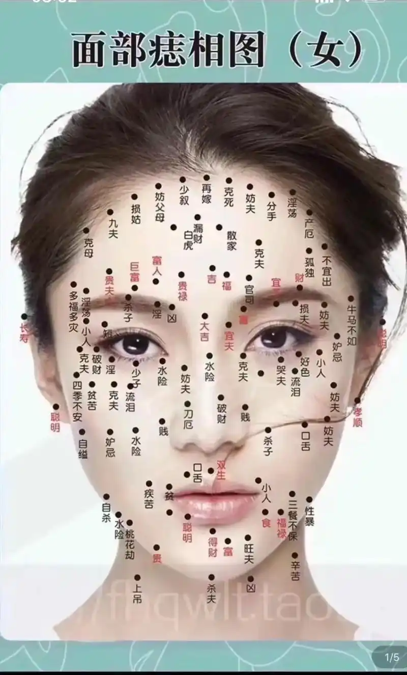 有些痣真的是可以改变命运的,你觉得哪里不好了,真的是要把它点掉