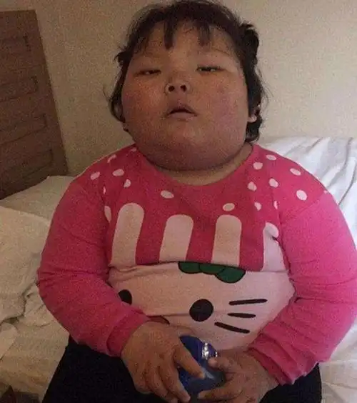 6岁女娃过度肥胖,导致性早熟,原来都是这些东西惹得祸