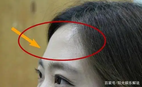 女人额头出现了"三条杠",知道代表什么吗?别傻傻的不在意!