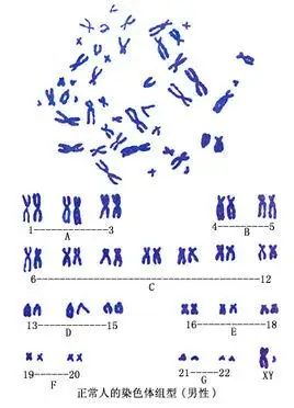 染色体组型