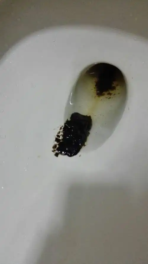 大便黑色 我是不是得病了