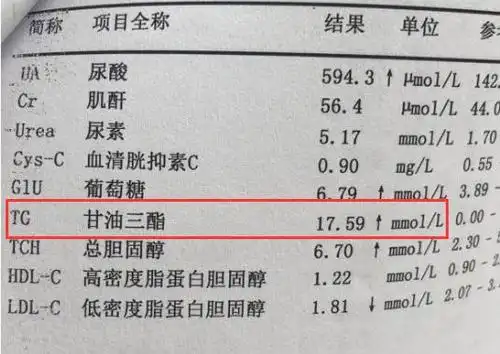 甘油三酯偏高,喝水时加1物,甘油三酯降到1.5,血管不堵塞