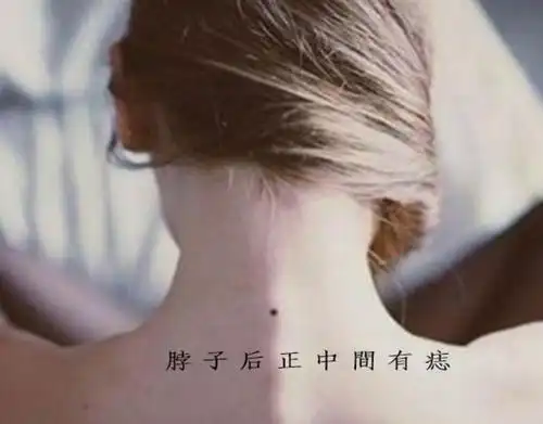 痣长在脖子后面有什么特殊的含义吗?