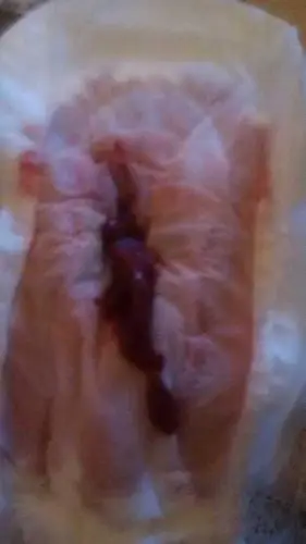 月经来了个这个东西!