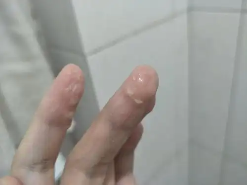 姐妹们能不能帮我看看这个是不是豆腐渣白带吗有图慎入