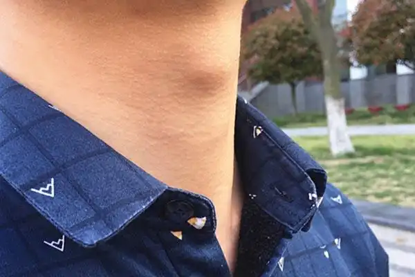 喉结什么时候长喉结图片