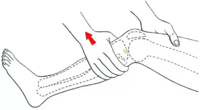 lachman试验是前交叉韧带不稳的最敏感检查方法,对于大腿较粗的患者