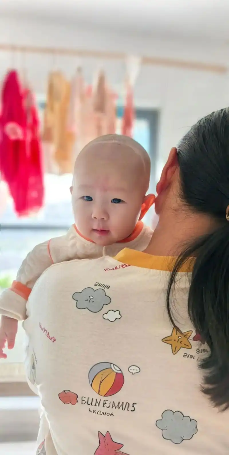 六月龄宝宝额骨这样突出,有问题吗?#ai扩图 #人类幼崽 平