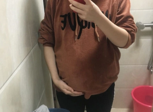 因为褐色分泌物出现都是暗示着先兆流产的