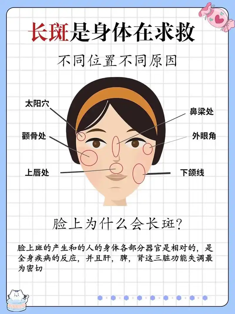 有很多女性脸上都有斑斑点点 - 抖音