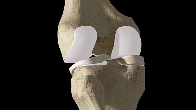 头条问答 - 14岁的少年每天跑步两公里还加吃钙片,还会长个吗?