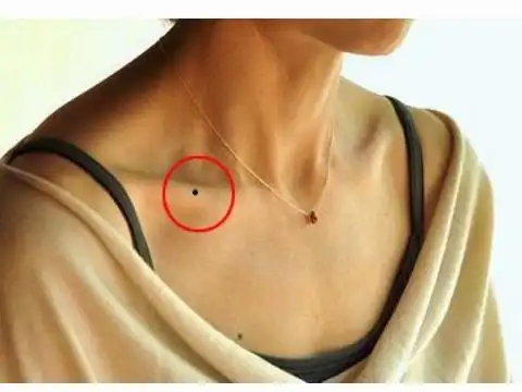 锁骨有痣的人是什么样的