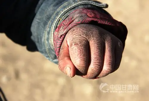 甘肃会宁:你的小手冻裂了 我们流泪了