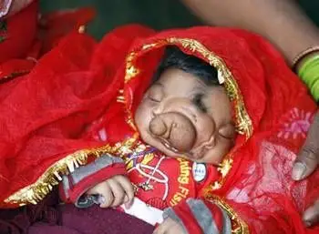 印度女产双头宝宝盘点全球恐怖畸形婴儿图