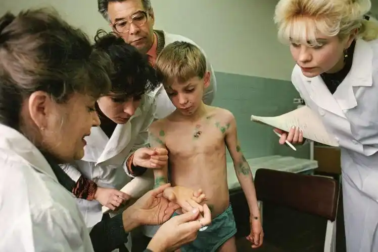 切尔诺贝利核泄漏30周年专访gerdludwig