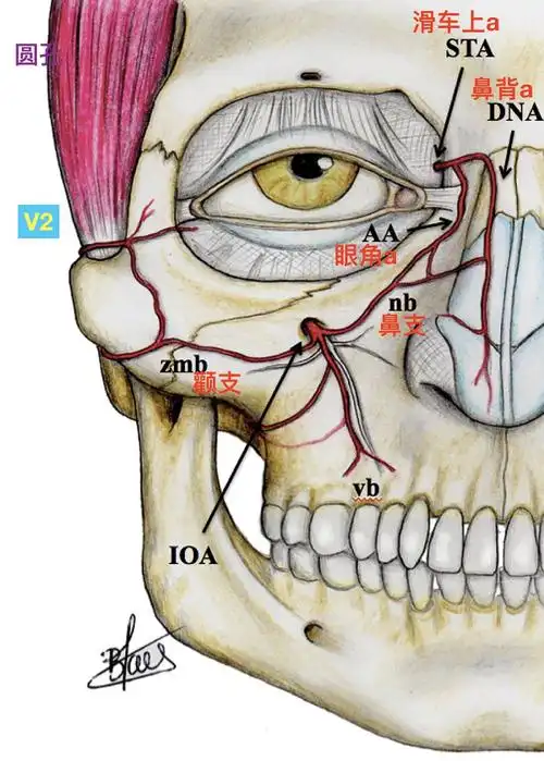 眶下动脉出眶下孔后,主要分布于面部的组织,是面部血供的来源之一.