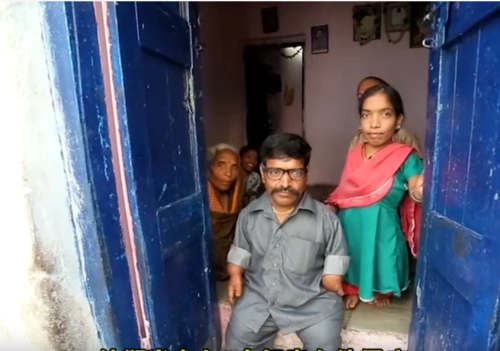 软骨发育不全是一种最常见的不成比例的侏儒症,其特征是有着正常