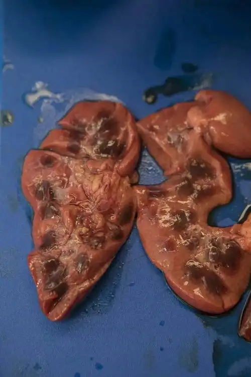 真实的尸检是怎样进行的