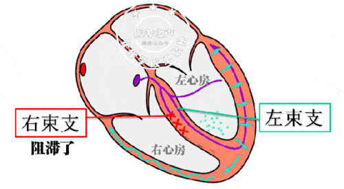 高潮来啦:零基础都秒懂的心电图(中篇),你绝逼没见过如此牛x的文章!