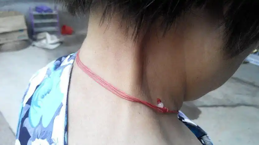 家里老人这两天脖颈部位凸起一根筋,差不多有一周左