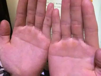 女人双手断掌纹的命运如何