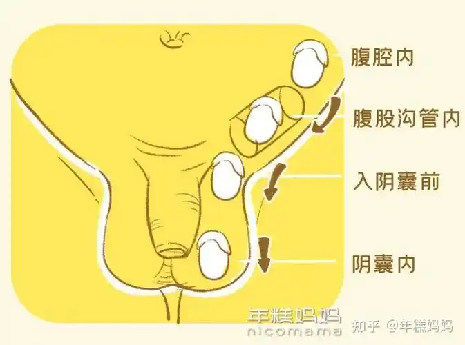 小心耽误孩子男宝蛋蛋出现这几种情况要重视越早检查越好
