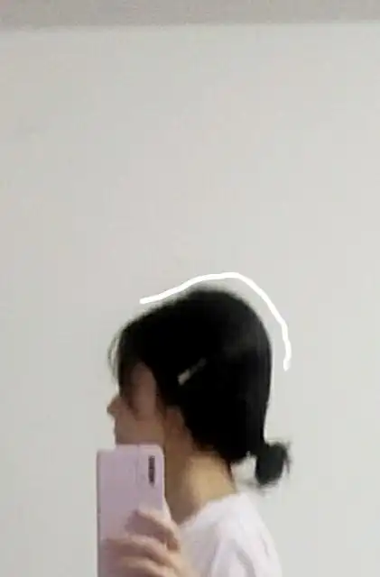 我后脑勺很扁.从高中开始就发现自己的头跟别人不一样