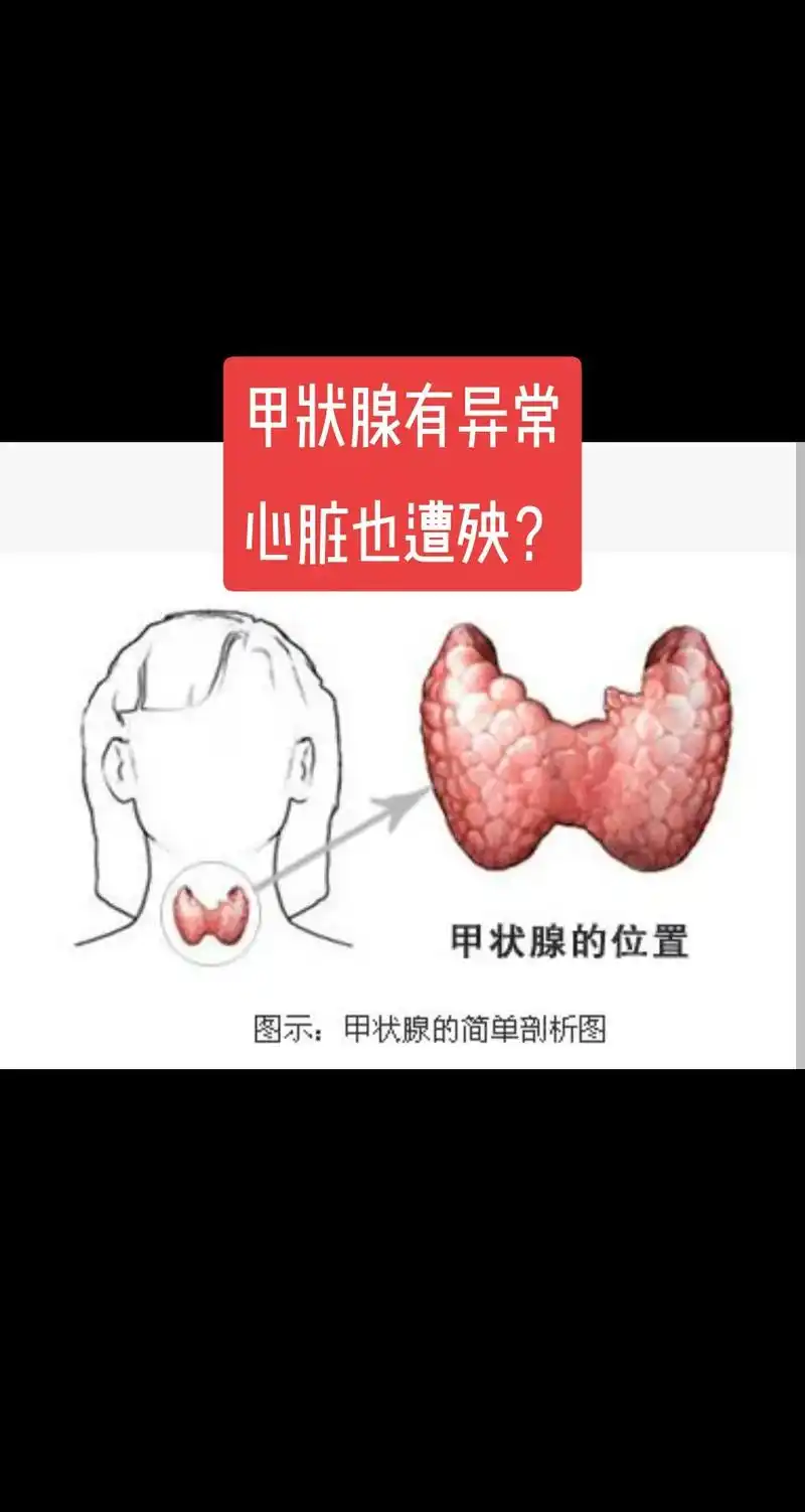 心慌心悸,可能是甲状腺惹的祸.0303030303一些患者 - 抖音