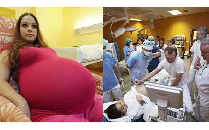 23岁妈孕肚超大「以为怀上双胞胎」 产检时发现「480年来才出现的奇迹