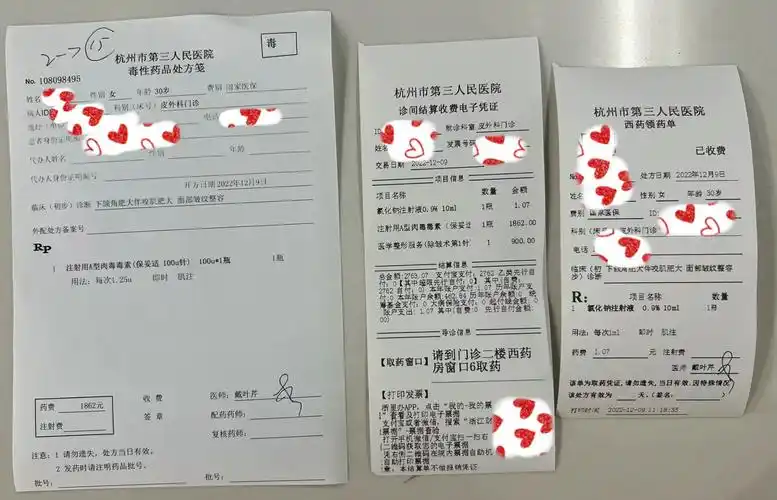 公立三甲杭州三院肉毒素去皱瘦咬肌