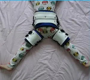 儿童可调髋关节外展支具蛙式铰链支架髋关节发育不良固定器医用