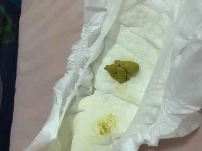 新生儿7天大便干硬