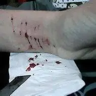 带血的伤感自残头像图片大全点击鼠标右键下载