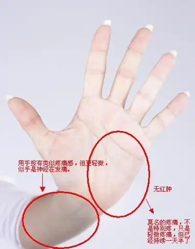 左手手掌痛怎么回事?该怎么办?