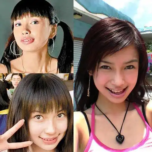 baby自晒牙套丑照 整与不整其实不重要了_新浪四川时尚_新浪四川