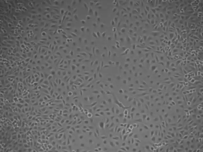 人主动脉内皮细胞