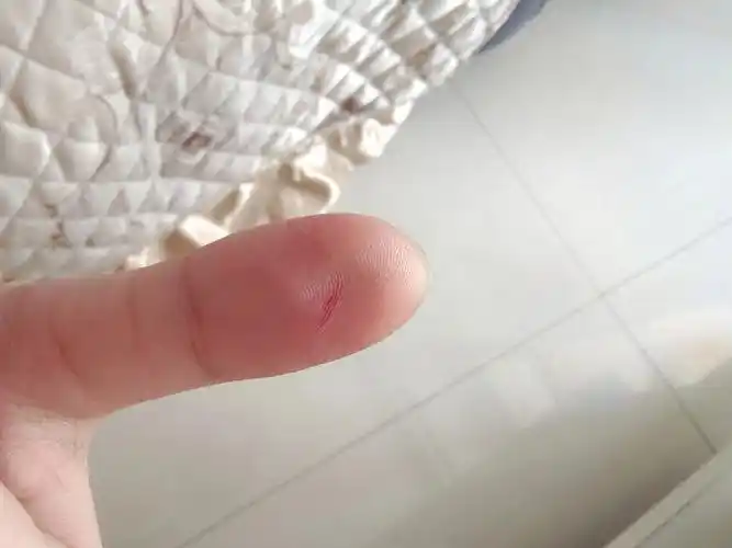 仓鼠咬终归逃不了这一劫