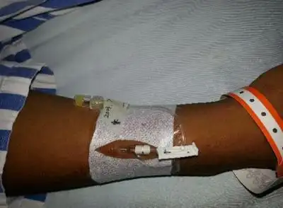 留置针是干嘛的优质