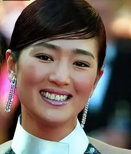 巩俐与同一时期的林青霞和张曼玉不同,她脸部较长,颧骨突出,太阳穴