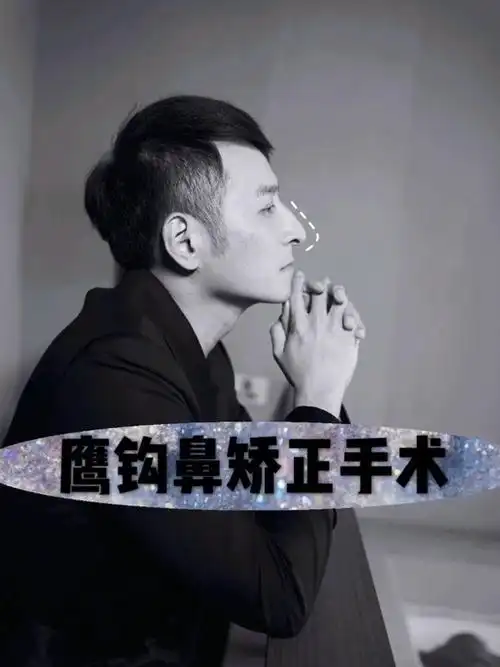 97什么是鹰钩鼻鹰钩鼻子是一种很严重鼻部畸形,它又叫_圈子-新氧