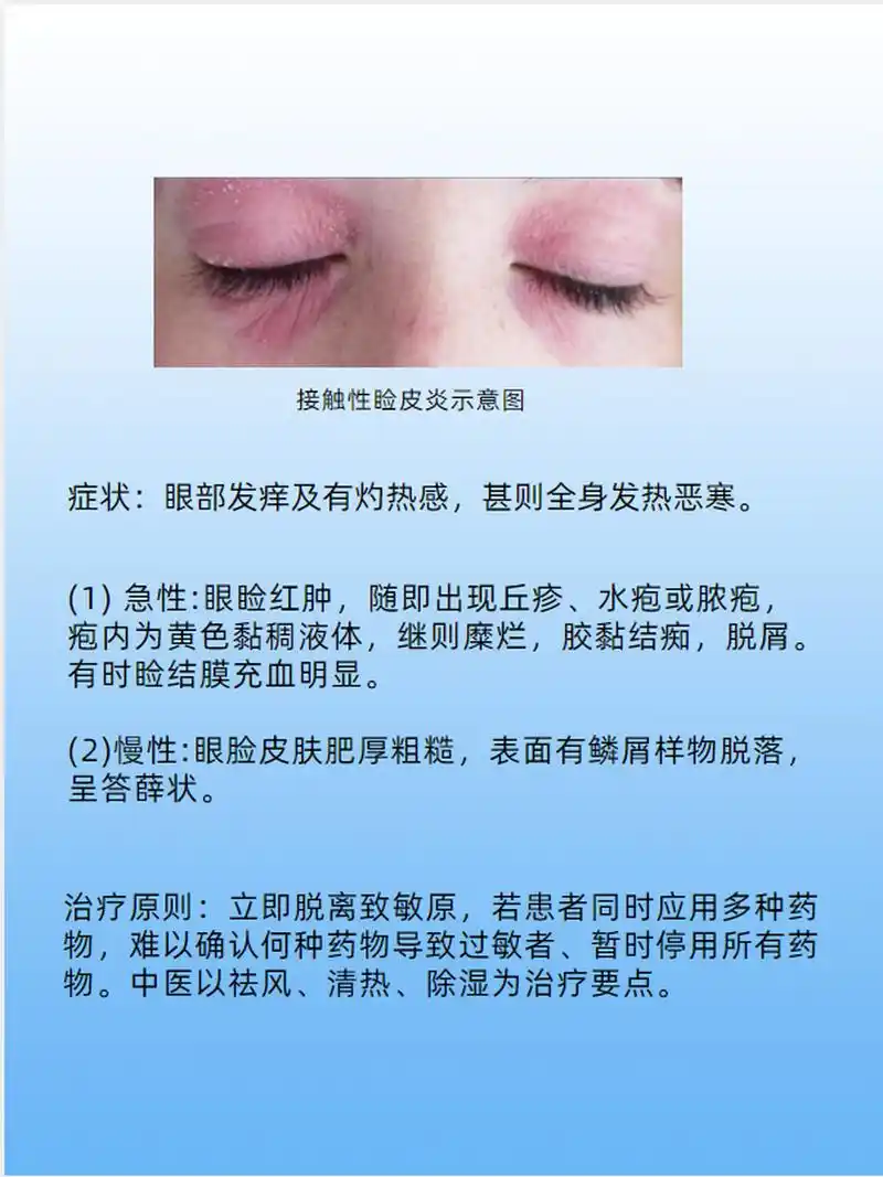 什么是接触性睑皮炎呢?