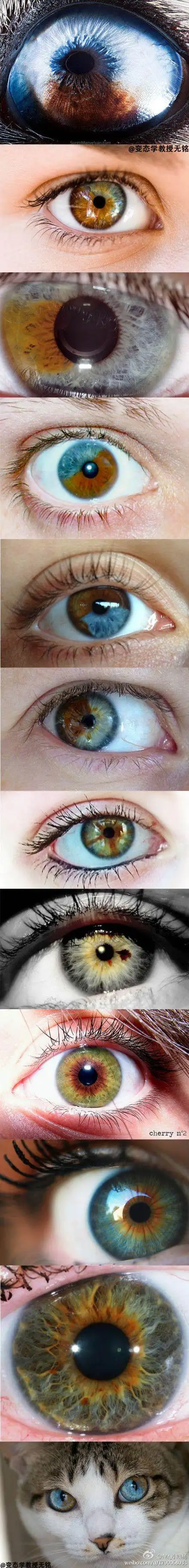 稀有的眼睛 虹膜异色症